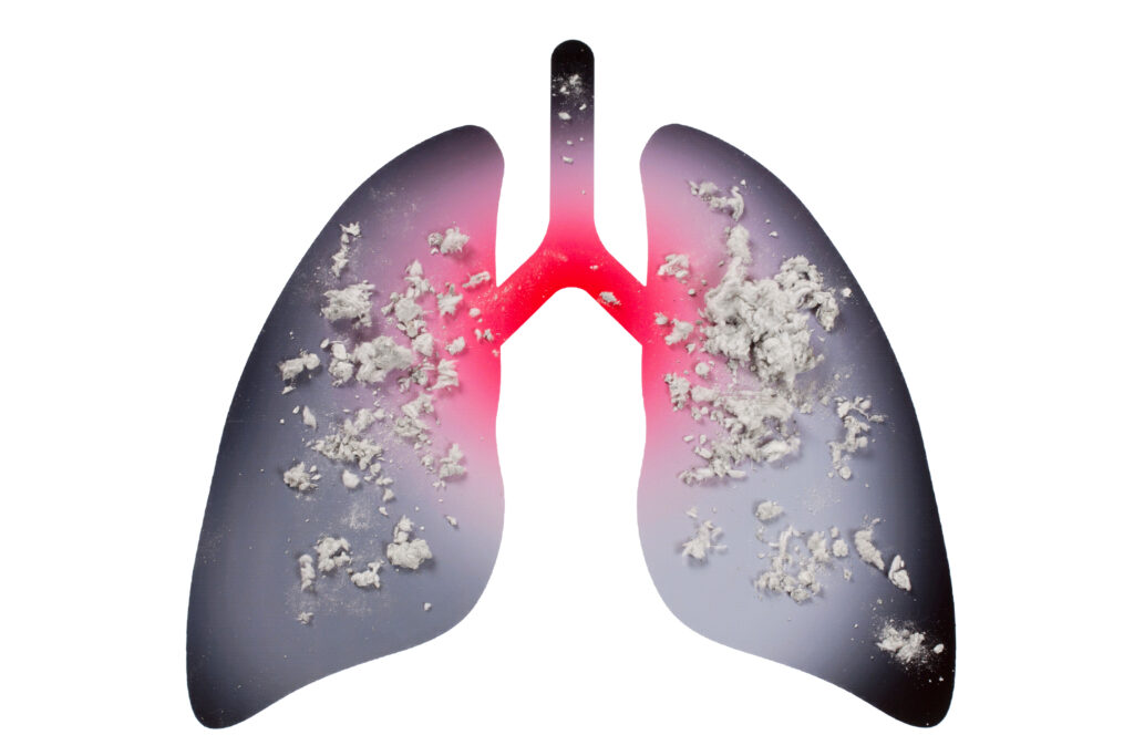 asbestos-in-the-lung